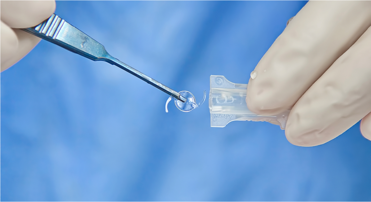 Chirurgie de la cataracte